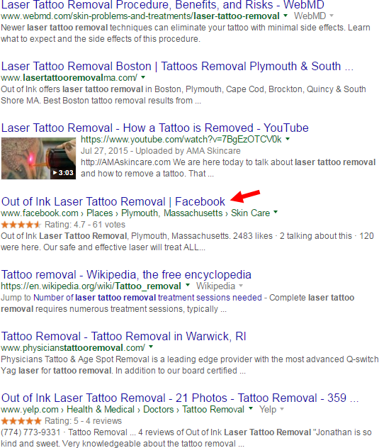 Tattoo removal - Wikipedia